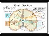 Photos of Abdominal Migraine Treatment