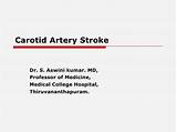 Images of Carotid Artery Stroke Recovery