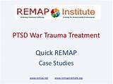 Images of Secondary Ptsd Treatment