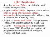 Clinical Signs Of Pulmonary Hypertension Photos