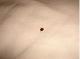 Park Central Hotel New York Bed Bugs Photos