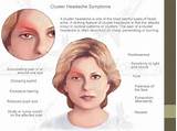 Migraine Light Sensitivity Treatment Pictures