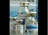 Mri With Gadolinium Contrast Side Effects Photos