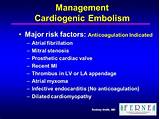 Images of Management Of Dilated Cardiomyopathy