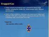 Photos of How To Pass Trapped Gas