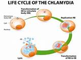 Images of Cure Chlamydia Without Going Doctor