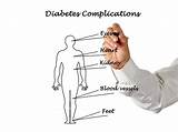 Pictures of Diabetes Quiz For Doctors