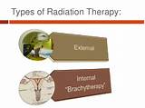 Images of Radiation Seed Therapy