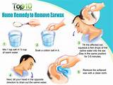 Pictures of Build Up Ear Wax Home Remedies