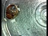 Steps To Get Rid Of Bed Bugs Photos