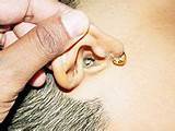 How Do Doctors Clean Ears Pictures