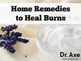 Photos of Steam Burn Home Remedies