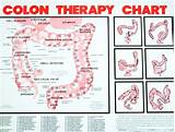 Colon Therapy Pictures