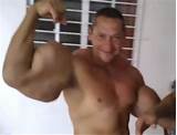 Photos of Synthol Side Effect