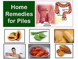 Photos of 3 Home Remedies For Hemorrhoids Pain