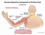 Rectal Muscle Exercises Photos