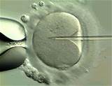 Ivf Treatment Uk Pictures