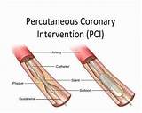 Pci Medical Photos