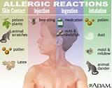 Images of Home Remedies For Allergic Reactions On Face