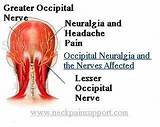Photos of Occipital Muscle Exercises