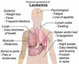 Chronic Myeloid Leukemia Treatment Drugs Pictures