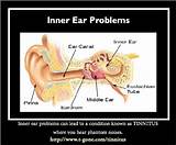 Ear Balance Problem