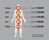 Photos of Price Of Kidney