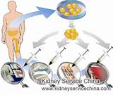 Stem Cell Therapy For Kidney Failure Photos