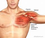 Deltoid Muscle Pain Treatment Images