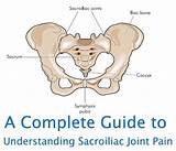 Sacroiliac Joint Pain Treatment Exercises Pictures