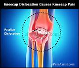 Pictures of Kneecap Pain Home Remedies