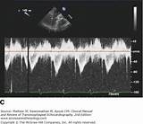 Clinical Manual And Review Of Transesophageal Echocardiography Images