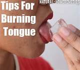 Home Remedies For Burning Tongue Images