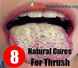 Natural Treatment For Thrush On Tongue Images