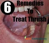 Male Thrush Home Remedies Pictures