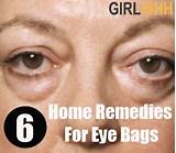 Droopy Eyelids Home Remedies Photos