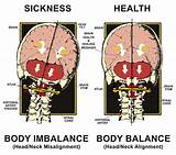 Pictures of Spinal Balance Omaha