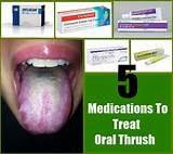 Thrush Mouth Treatment Adults Images