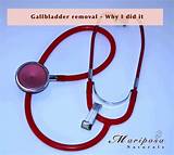 Gallbladder Emergency Images