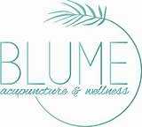 Acupuncture For Balanced Wellness