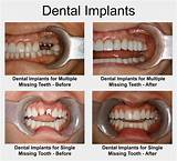 Clear Choice Dental Implants Houston Photos