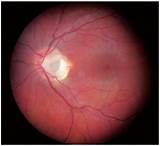 Clinical Pearls For Optometry Pictures