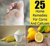 Corn Toes Home Remedies Photos