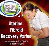 Images of Recovery After Fibroid Surgery