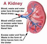Pictures of Stem Cell Therapy For Kidney Failure