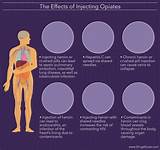 Pictures of Opiates Depression Treatment