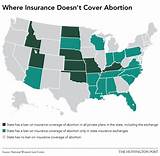 Abortion And Health Insurance Images