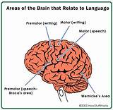 What Part Of The Brain Controls Speech And Motor Skills Images