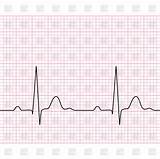 Pictures of Medical Ekg