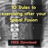 Exercise Program After Spinal Fusion Images